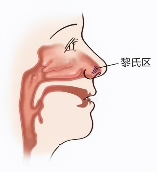 挖鼻孔导致颅内感染儿童（8岁娃颅内感染竟是因为）(12)