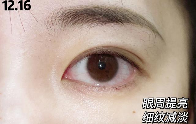 好用的去黑眼圈的眼霜排行榜（能够淡化黑眼圈的眼霜）(7)