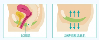 ​产后修复怎么修复 产后修复全攻略！需要的赶紧收藏哦