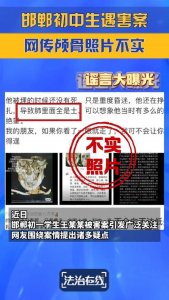 ​网传邯郸初中生遇害案颅骨照片不实